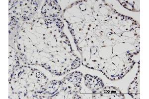 Immunoperoxidase of monoclonal antibody to TBX22 on formalin-fixed paraffin-embedded human placenta.
