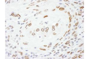 Immunohistochemistry (IHC) image for anti-Lamin A/C (LMNA) (AA 400-450) antibody (ABIN7455219)