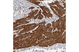 Immunohistochemical staining of human smooth muscle with C11orf48 polyclonal antibody  shows strong cytoplasmic positivity in smooth muscle cells. (C11orf48 anticorps)