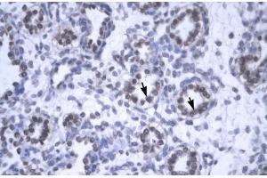 Rabbit Anti-YEATS4 Antibody  Paraffin Embedded Tissue: Human Lung Cellular Data: Alveolar cells Antibody Concentration: 4. (GAS41 anticorps  (Middle Region))