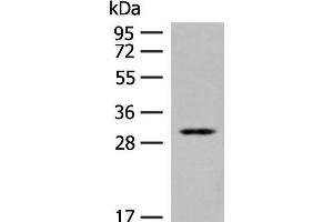 Western blot analysis of Human kidney tissue lysate using TPMT Polyclonal Antibody at dilution of 1:400 (TPMT anticorps)