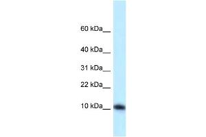 WB Suggested Anti-Med21 Antibody   Titration: 1. (MED21 anticorps  (N-Term))