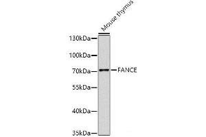 Western blot analysis of extracts of Mouse thymus using FANCE Polyclonal Antibody at dilution of 1:1000.