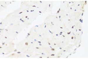 Immunohistochemistry of paraffin-embedded Rat heart using IRF3 Polyclonal Antibody at dilution of 1:100 (40x lens). (IRF3 anticorps)