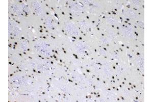 IHC analysis of MED18 using anti-MED18 antibody . (MED18 anticorps  (AA 1-208))