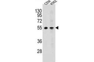 Western Blotting (WB) image for anti-Melanin-Concentrating Hormone Receptor 1 (MCHR1) antibody (ABIN2995780)