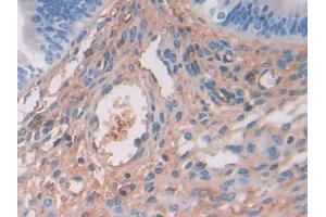 IHC-P analysis of Mouse Uterus Tissue, with DAB staining. (SERPINA3 anticorps  (AA 23-253))