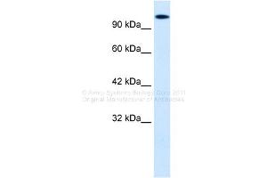 WB Suggested Anti-HIPK2 Antibody Titration:  0. (HIPK2 anticorps  (Middle Region))