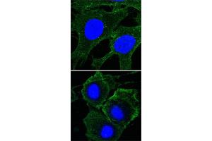 Confocal immunofluorescence analysis of HeLa (upper) and HepG2 (bottom) cells using KDR monoclonal antibody, clone 4B4  (green) . (VEGFR2/CD309 anticorps)