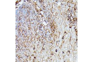 Immunohistochemistry of paraffin-embedded human esophageal using HLA-B antibody (ABIN1513015, ABIN3021868, ABIN3021869 and ABIN6216628) at dilution of 1:100 (40x lens). (HLA-B anticorps  (AA 1-100))