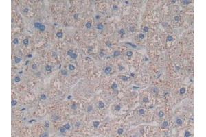 Detection of CCL3L1 in Human Liver Tissue using Polyclonal Antibody to Chemokine C-C-Motif Ligand 3 Like Protein 1 (CCL3L1)