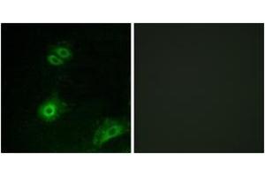 Immunofluorescence analysis of A549 cells, using OR4A16 Antibody. (OR4A16 anticorps  (AA 261-310))