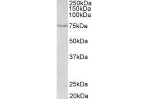 Western Blotting (WB) image for anti-Solute Carrier Family 6 (Neurotransmitter Transporter, serotonin), Member 4 (SLC6A4) (C-Term) antibody (ABIN2465034) (SLC6A4 anticorps  (C-Term))