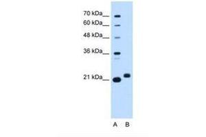 Image no. 1 for anti-Chromosome 1 Open Reading Frame 159 (C1orf159) (AA 93-142) antibody (ABIN6738341) (C1orf159 anticorps  (AA 93-142))