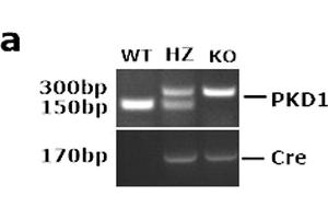 PKD1 was deleted specifically in transgenic mice. (SP7 anticorps  (AA 331-431))