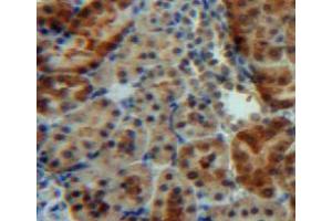 Used in DAB staining on fromalin fixed paraffin-embedded kidney tissue