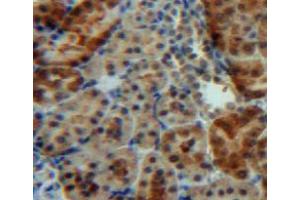 Used in DAB staining on fromalin fixed paraffin-embedded kidney tissue (IGFBP5 anticorps  (AA 25-271))