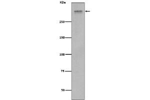 Western blot analysis of Plectin expression in Jurkat cell lysate.