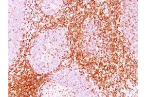 Image no. 2 for anti-CD6 (CD6) antibody (ABIN6160102) (CD6 anticorps)