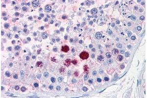 Human Testis: Formalin-Fixed, Paraffin-Embedded (FFPE) (ENPP3 anticorps  (C-Term))