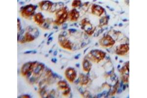 IHC-P analysis of Stomach tissue, with DAB staining. (CD103 anticorps  (AA 671-917))