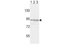 Western blot analysis of TYRO10 Antibody in Jurkat (lane 1), 293 (lane 2) and Hela (lane 3) cell line lysates (35 ug/lane). (DDR2 anticorps)