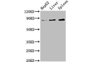Western Blot Positive WB detected in: HepG2 whole cell lysate, Rat liver tissue, Mouse spleen tissue All lanes: NSUN2 antibody at 6. (NSUN2 anticorps  (AA 432-509))