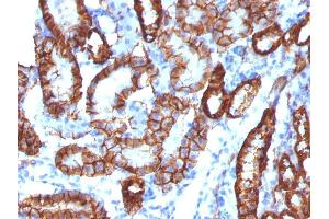 Formalin-fixed, paraffin-embedded Mouse Kidney stained with KSP-Cadherin Rabbit Recombinant Monoclonal Antibody (CDH16/1532R)