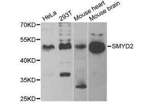 Western blot analysis of extracts of various cell lines, using SMYD2 antibody. (SMYD2A anticorps)