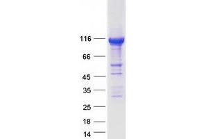 Validation with Western Blot