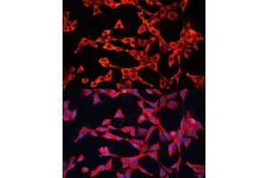 Immunofluorescence analysis of NIH/3T3 cells using GDI2 antibody (ABIN6129647, ABIN6141048, ABIN6141049 and ABIN7101828) at dilution of 1:100.