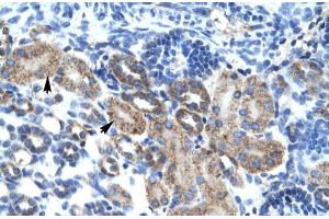 Human kidney; CGI-62 antibody - C-terminal region in Human kidney cells using Immunohistochemistry