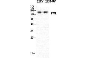 Western Blot (WB) analysis of specific cells using PML Polyclonal Antibody. (PML anticorps  (N-Term))