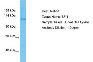 Host: Rabbit Target Name: SFI1 Sample Type: Jurkat Whole Cell lysates Antibody Dilution: 1. (SFI1 anticorps  (C-Term))