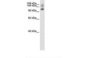 Image no. 1 for anti-Splicing Factor, Suppressor of White-Apricot Homolog (SFSWAP) (N-Term) antibody (ABIN204961) (SFRS8 anticorps  (N-Term))