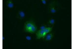 Anti-LIPG mouse monoclonal antibody (ABIN2453246) immunofluorescent staining of COS7 cells transiently transfected by pCMV6-ENTRY LIPG (RC209248). (LIPG anticorps)