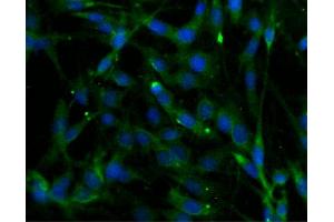 Immunofluorescent staining of C6 cells (Rat glioma, ATCC CCL-107) (right).