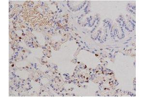 ABIN6267606 at 1/200 staining Rat lung tissue sections by IHC-P.