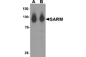 Western blot analysis of SARM in human kidney tissue lysate with SARM antibody at (A) 1 and (B) 2 µg/mL. (SARM1 anticorps  (N-Term))