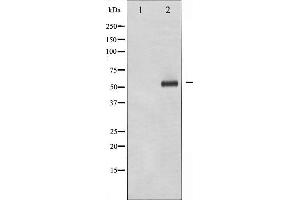 Western blot analysis of p56 Dok-2 phosphorylation expression in K562 whole cell lysates,The lane on the left is treated with the antigen-specific peptide.