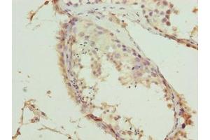 Immunohistochemistry of paraffin-embedded human testis tissue using ABIN7173492 at dilution of 1:100 (TRMT6 anticorps  (Catalytic Subunit))