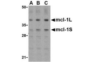 Image no. 1 for anti-Induced Myeloid Leukemia Cell Differentiation Protein Mcl-1 (MCL1) (Internal Region) antibody (ABIN207776) (MCL-1 anticorps  (Internal Region))