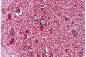 Anti-NR4A3 antibody  ABIN1049141 IHC staining of human brain, cortex.