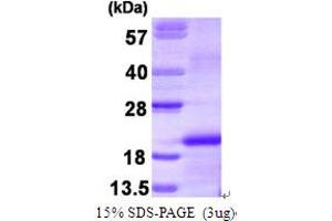SDS-PAGE (SDS) image for Colony Stimulating Factor 1 (Macrophage) (CSF1) (AA 33-190) protein (His tag) (ABIN666654)