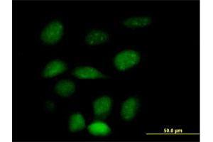 Immunofluorescence of purified MaxPab antibody to ZNF157 on HeLa cell.