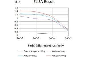 Black line: Control Antigen (100 ng),Purple line: Antigen (10 ng), Blue line: Antigen (50 ng), Red line:Antigen (100 ng)