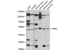 Western blot analysis of extracts of various cell lines, using WNT1 antibody (ABIN1683291, ABIN3016105, ABIN3016107 and ABIN6219551) at 1:1000 dilution. (WNT1 anticorps  (AA 231-370))