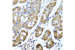 Immunohistochemistry of paraffin-embedded human stomach using HYAL1 antibody (ABIN5975045) at dilution of 1/100 (40x lens). (HYAL1 anticorps)