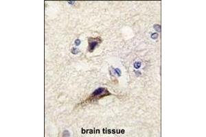 Formalin-fixed and paraffin-embedded human brain tissue reacted with NTF3 antibody (Center) (ABIN392182 and ABIN2841893) , which was peroxidase-conjugated to the secondary antibody, followed by DAB staining.