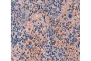 IHC-P analysis of spleen tissue, with DAB staining. (TPM3 anticorps  (AA 6-248))